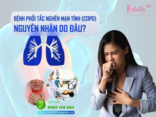 Bệnh Phổi Tắc Nghẽn Mạn Tính (COPD) - Những Điều Cần Biết