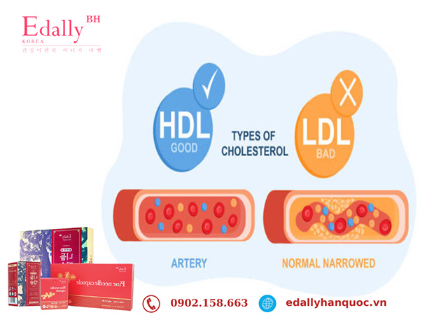 Phân biệt giữa LDL cholesterol và HDL cholesterol trong máu
