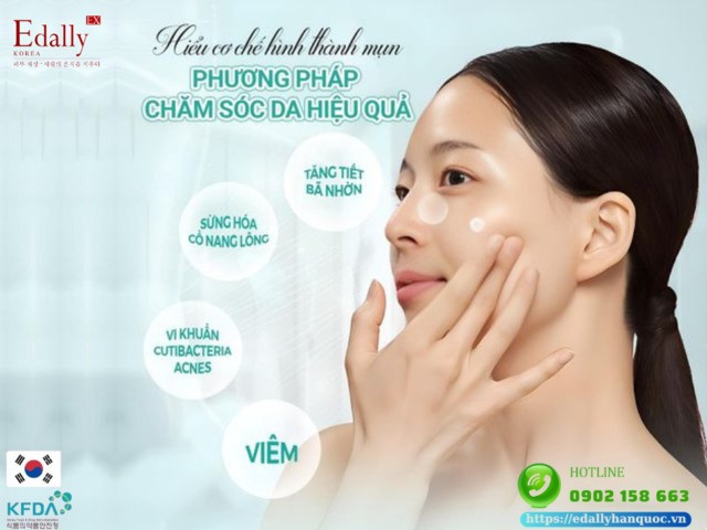 Mụn trứng cá được hình thành như thế nào?