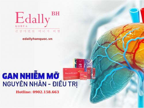 Bệnh Gan Nhiễm Mỡ Và Cách Điều Trị Hiệu Quả