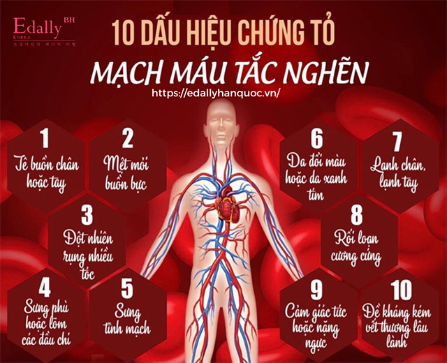 10 dấu hiệu chứng tỏ bạn đang bị tắc nghẽn mạch máu