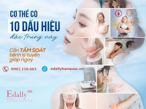 10 Dấu Hiệu Đặc Trưng Của Bệnh Lý Tuyến Giáp