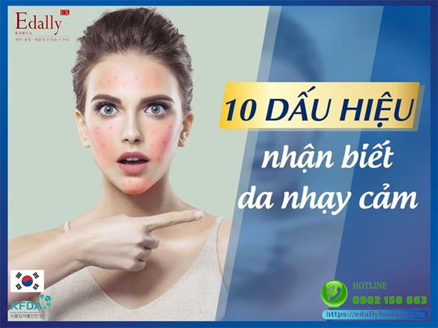 10 dấu hiệu nhận biết làn da nhạy cảm