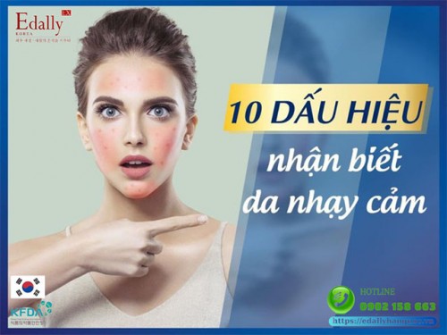 10 Dấu Hiệu Nhận Biết Da Nhạy Cảm