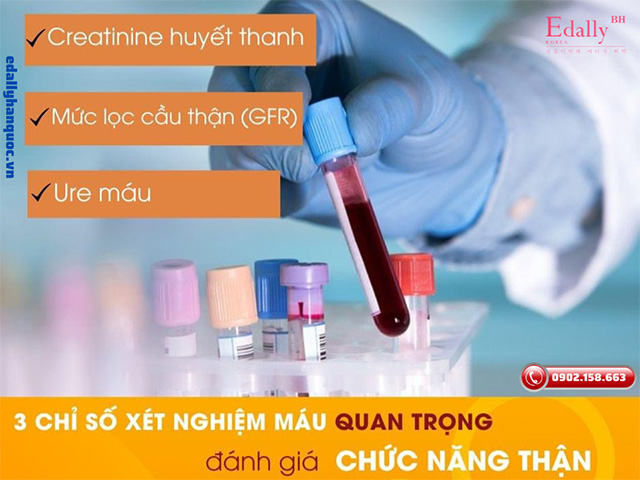 3 chỉ số xét nghiệm máu quan trọng đánh giá chức năng thận