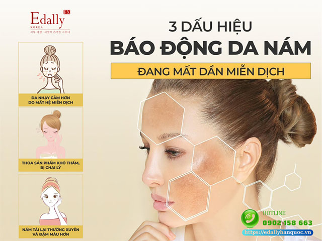 3 lý do da bị nám và tái lại, mãi không dứt do mất dần hệ miễn dịch