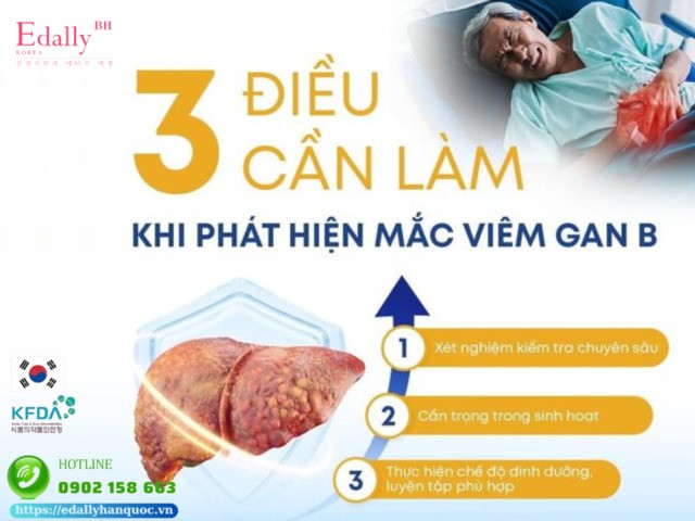 3 điều cần làm ngay nếu phát hiện bị mắc viêm gan B