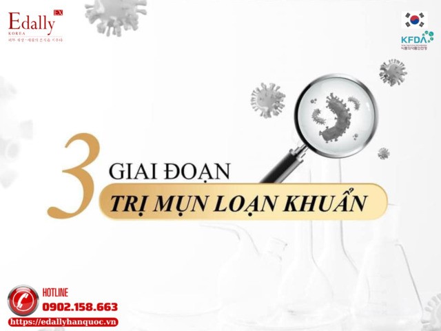 3 giai đoạn điều trị mụn loạn khuẩn hiệu quả