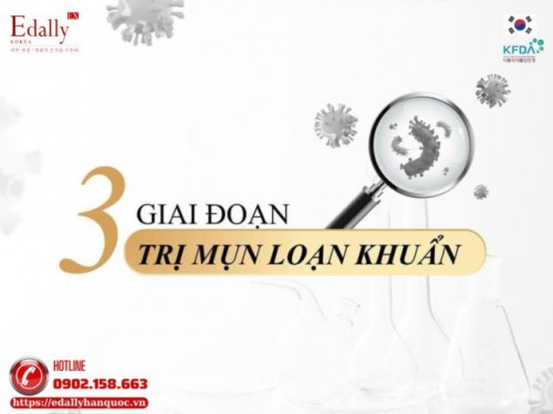 3 Giai Đoạn Điều Trị Mụn Loạn Khuẩn