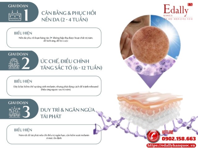 3 giai đoạn vàng trong điều trị nám da