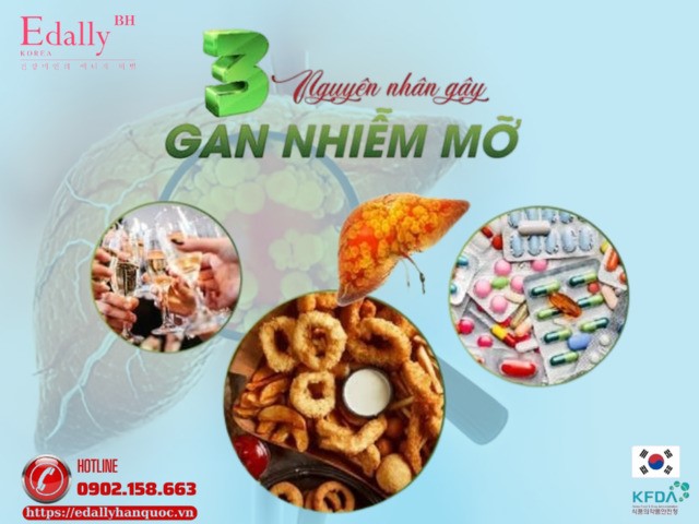 3 nguyên nhân gây bệnh gan nhiễm mỡ