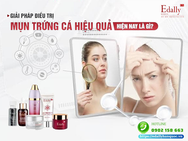 3 nguyên tắc điều trị mụn trứng cá bất di bất dịch là gì?