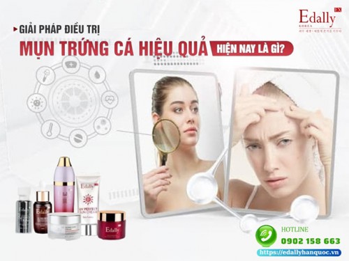 3 Nguyên Tắc Điều Trị Mụn Trứng Cá Bất Di Bất Dịch