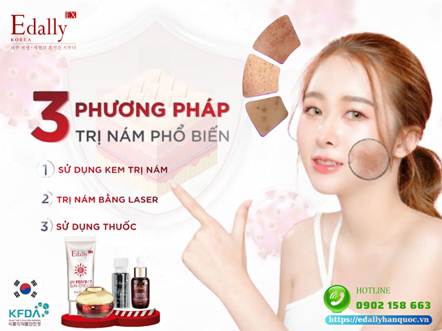 3 phương pháp điều trị nám da phổ biến hiện nay