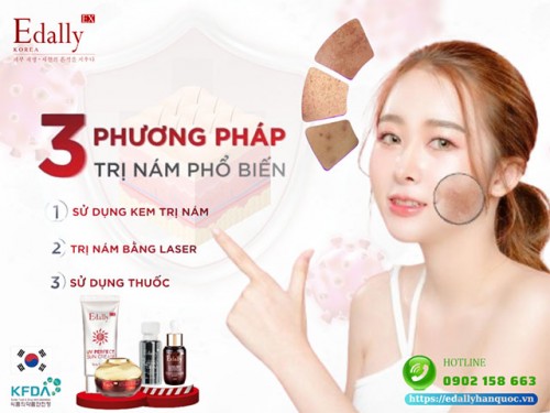 3 Phương Pháp Điều Trị Nám Da Phổ Biến Và Những Lưu Ý Quan Trọng