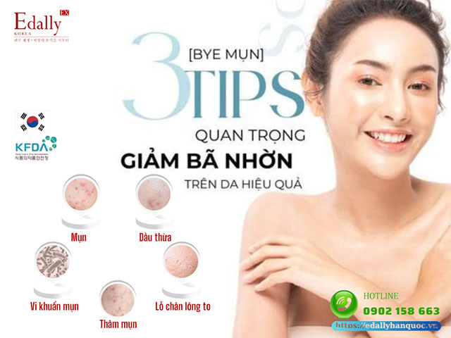 3 tips quan trọng giảm bã nhờn trên da hiệu quả