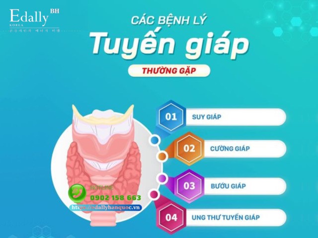 4 bệnh lý tuyến giáp thường gặp