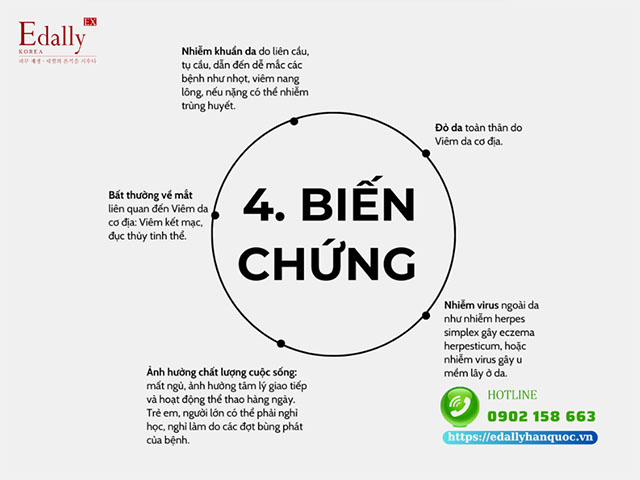 Những biến chứng của bệnh Viêm da cơ địa