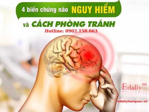 4 Biến Chứng Não Nguy Hiểm Của Tăng Huyết Áp Và Cách Phòng Tránh 