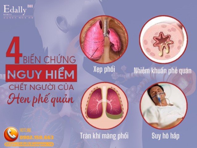 4 biến chứng nguy hiểm chết người của bệnh hen phế quản