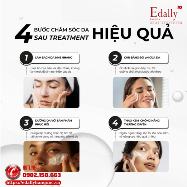 4 bước chăm sóc da sau treatment hiệu quả và an toàn