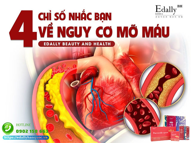 4 chỉ số cholesterol phụ nữ tuổi trung niên cần kiểm soát để phòng ngừa và kiểm soát bệnh tim mạch