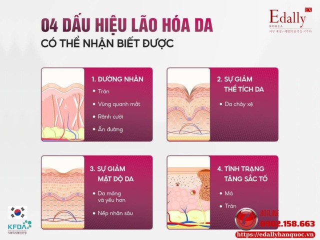 4 dấu hiệu lão hóa da có thể nhận biết được