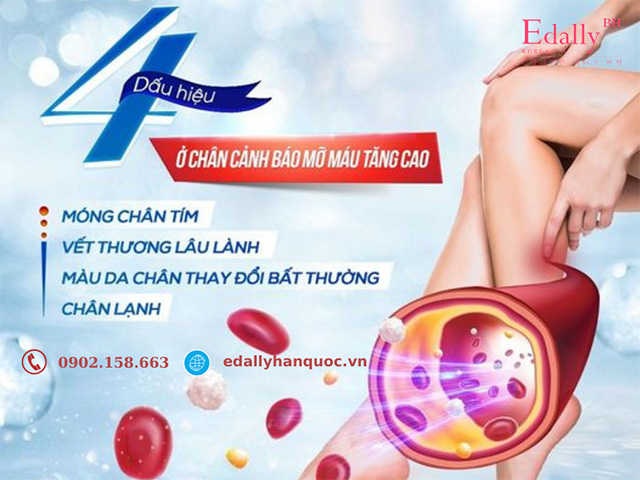 4 Dấu Hiệu Ở Chân Cảnh Báo Mỡ Máu Tăng Cao