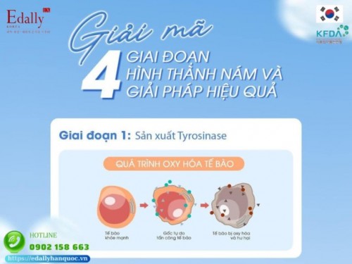 4 Giai Đoạn Hình Thành Nám Và Giải Pháp Lưu Giữ Thanh Xuân