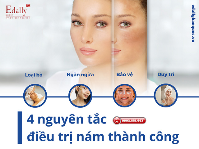 4 nguyên tắc điều trị nám da hiệu quả và thành công