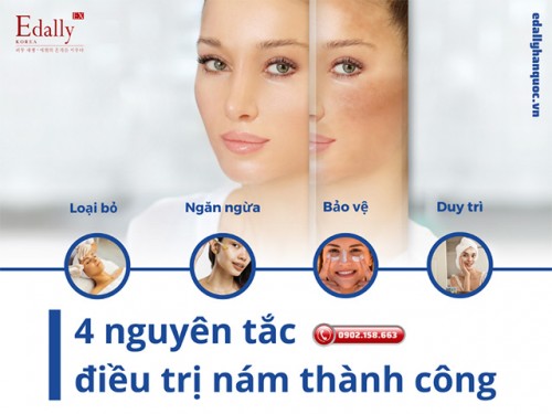 4 Nguyên Tắc Cần Nắm Để Trị Nám Da Hiệu Quả Hơn