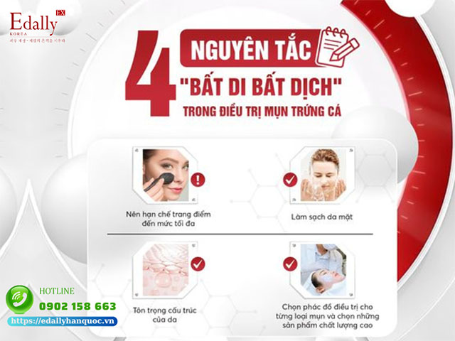 4 nguyên tắc bất di bất dịch trong điều trị mụn trứng cá