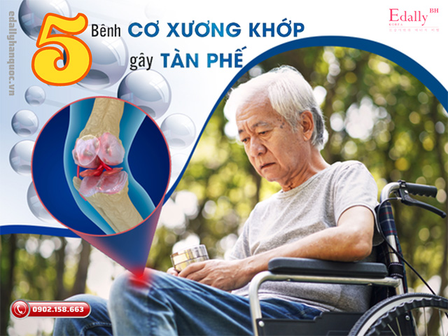 5 bệnh lý cơ xương khớp có biến chứng nguy hiểm cần hết sức đề phòng