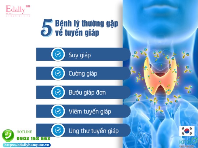 5 bệnh lý thường gặp về tuyến giáp