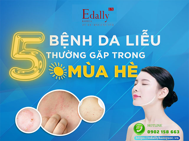 5 bệnh ngoài da thường gặp vào mùa hè cần hết sức lưu ý