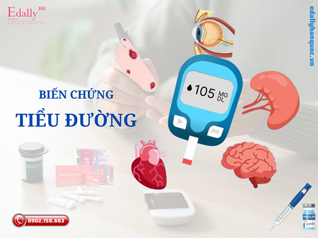 5 biến chứng nguy hiểm nhất của bệnh đái tháo đường