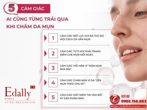 5 Cảm Giác Ai Cũng Từng Trải Qua Khi Chăm Da Mụn