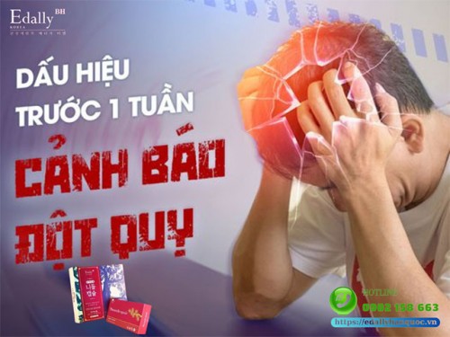 5 Dấu Hiệu Cảnh Báo Đột Quỵ Sắp Xảy Ra Trước 1 Tuần