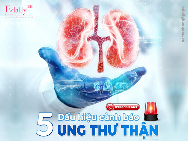 5 dấu hiệu cảnh báo nguy cơ ung thư thận cần hết sức lưy ý