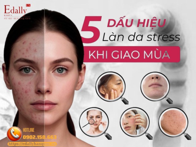 5 dấu hiệu làn da bị stress vào thời điểm giao mùa và cách khắc phục