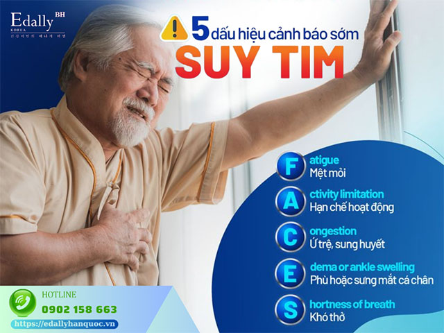 5 dấu hiệu giúp phát hiện sớm suy tim để phòng ngừa biến chứng