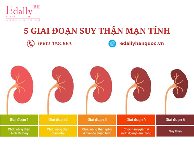 5 cấp độ suy thận mãn tính