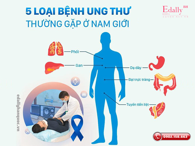 5 loại bệnh ung thư thường gặp phổ biến ở nam giới