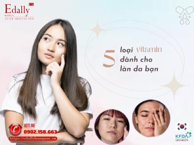 5 loại vitamin dành cho da mụn: Bí quyết nuôi dưỡng làn da khỏe mạnh