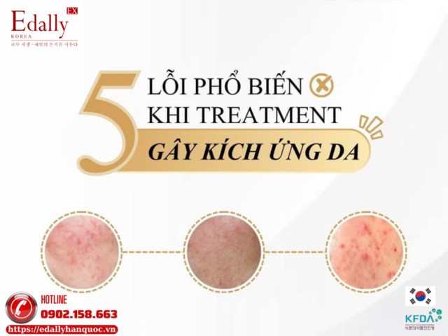 5 lỗi phổ biến khi treatment gây kích ứng da