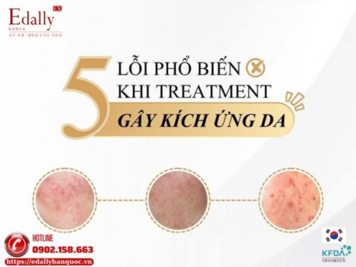 5 Lỗi Phổ Biến Khi Treatment Gây Kích Ứng Da