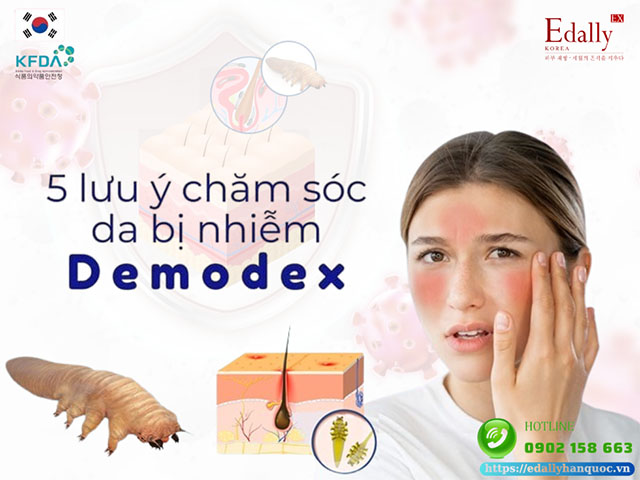 5 lưu ý khi chăm sóc da bị nhiễm Demodex để không bị tái phát