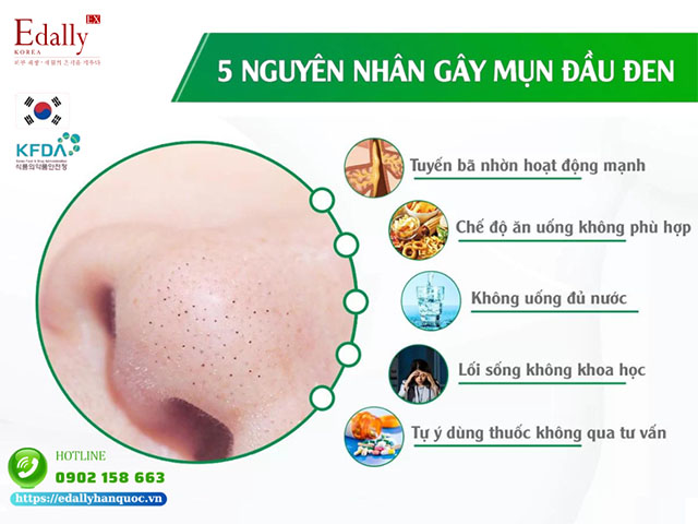 Những nguyên nhân chính gây ra mụn đầu đen