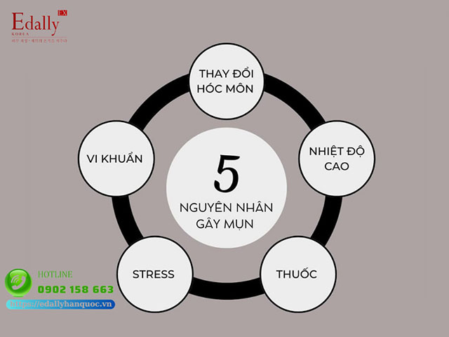 5 nguyên nhân gây ra mụn