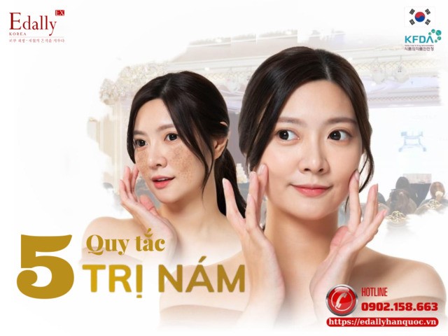 5 quy tắc điều trị nám da tại nhà an toàn, hiệu quả